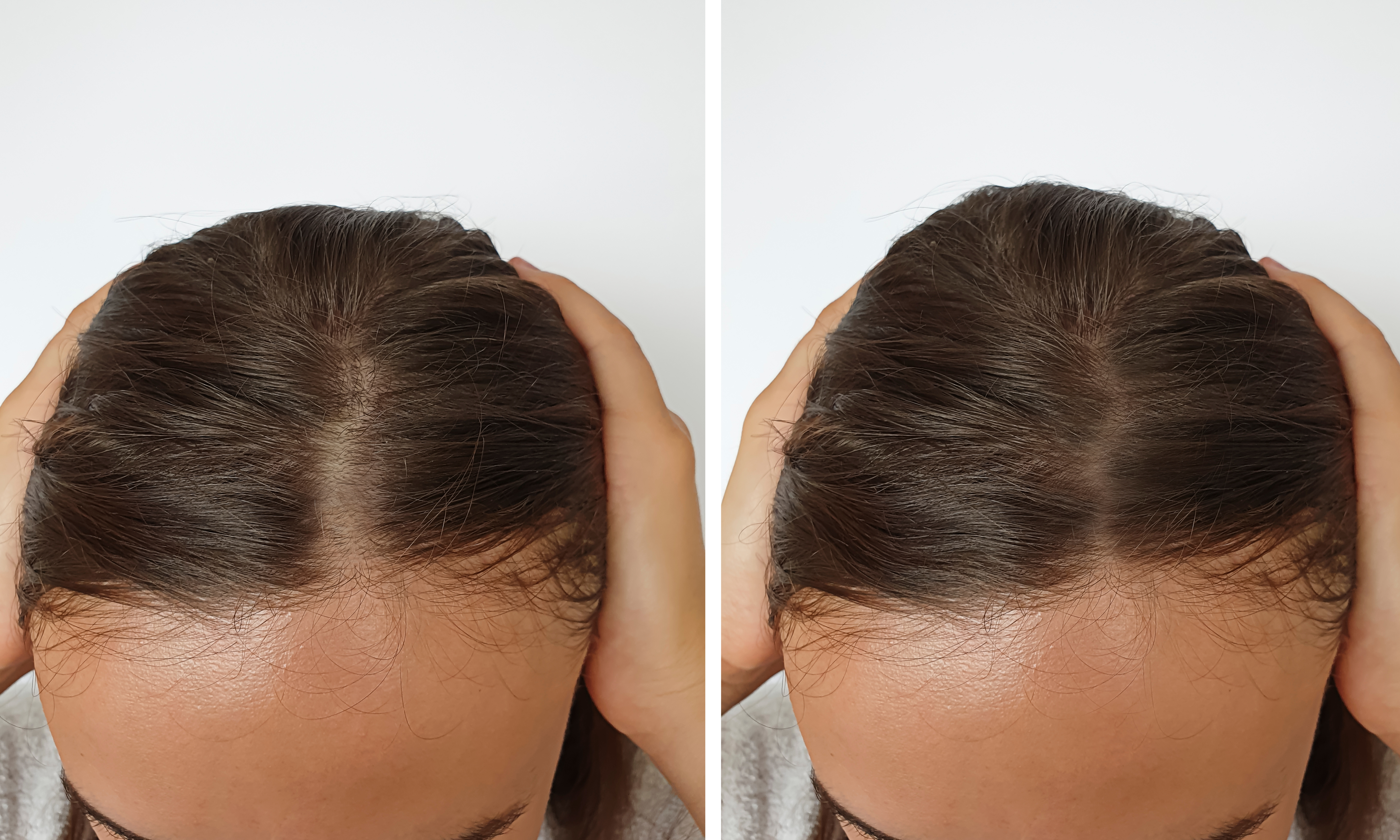 How to Fix Stunted Hair Growth