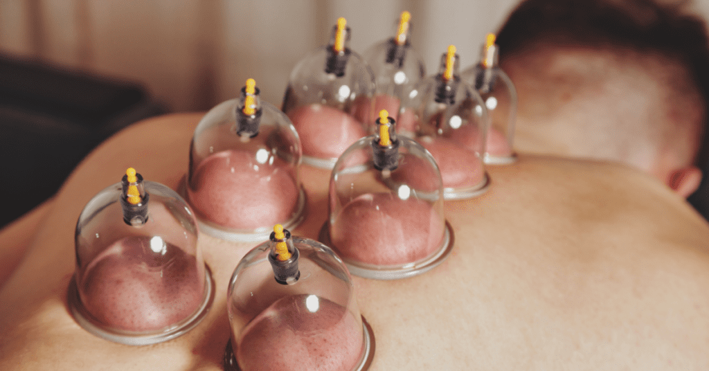 cupping therapy cups