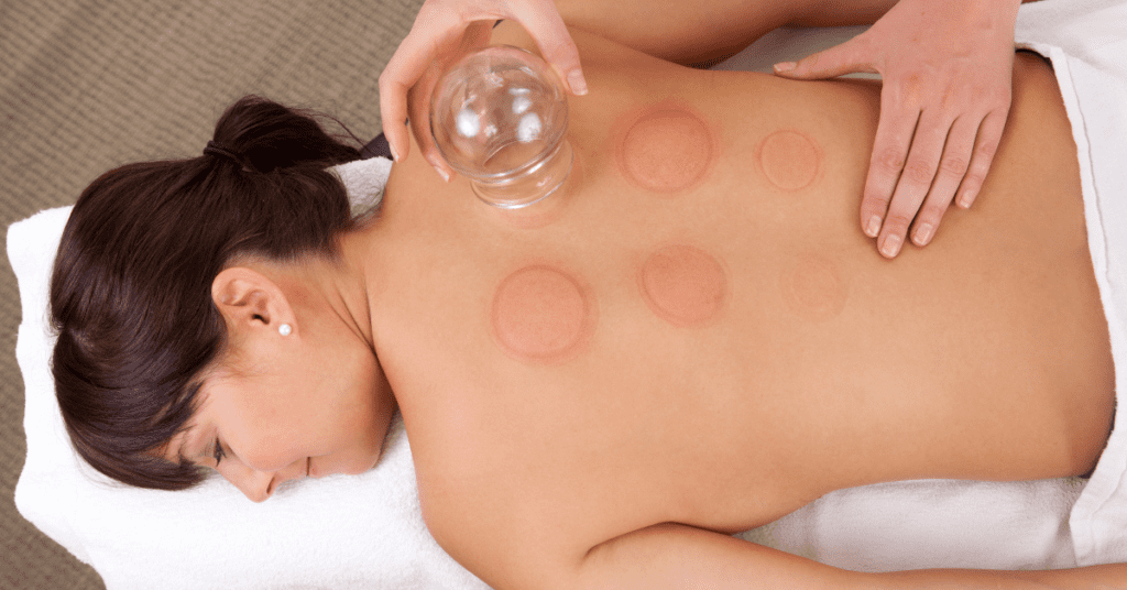 dry cupping therapy
